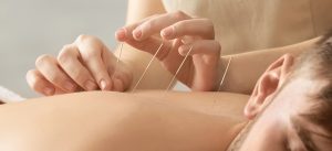 What are acupuncture and the different conditions that can be cured by this technique