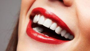 Improving Your Smile with Cosmetic Dental Veneers